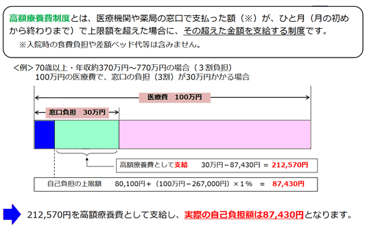 がん（癌）ガンの高額療養費制度